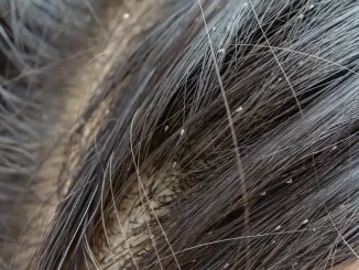 Lice Treatment for Long Thick Hair